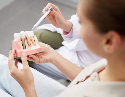 dentiste montrant un implant dentaire à schaerbeek